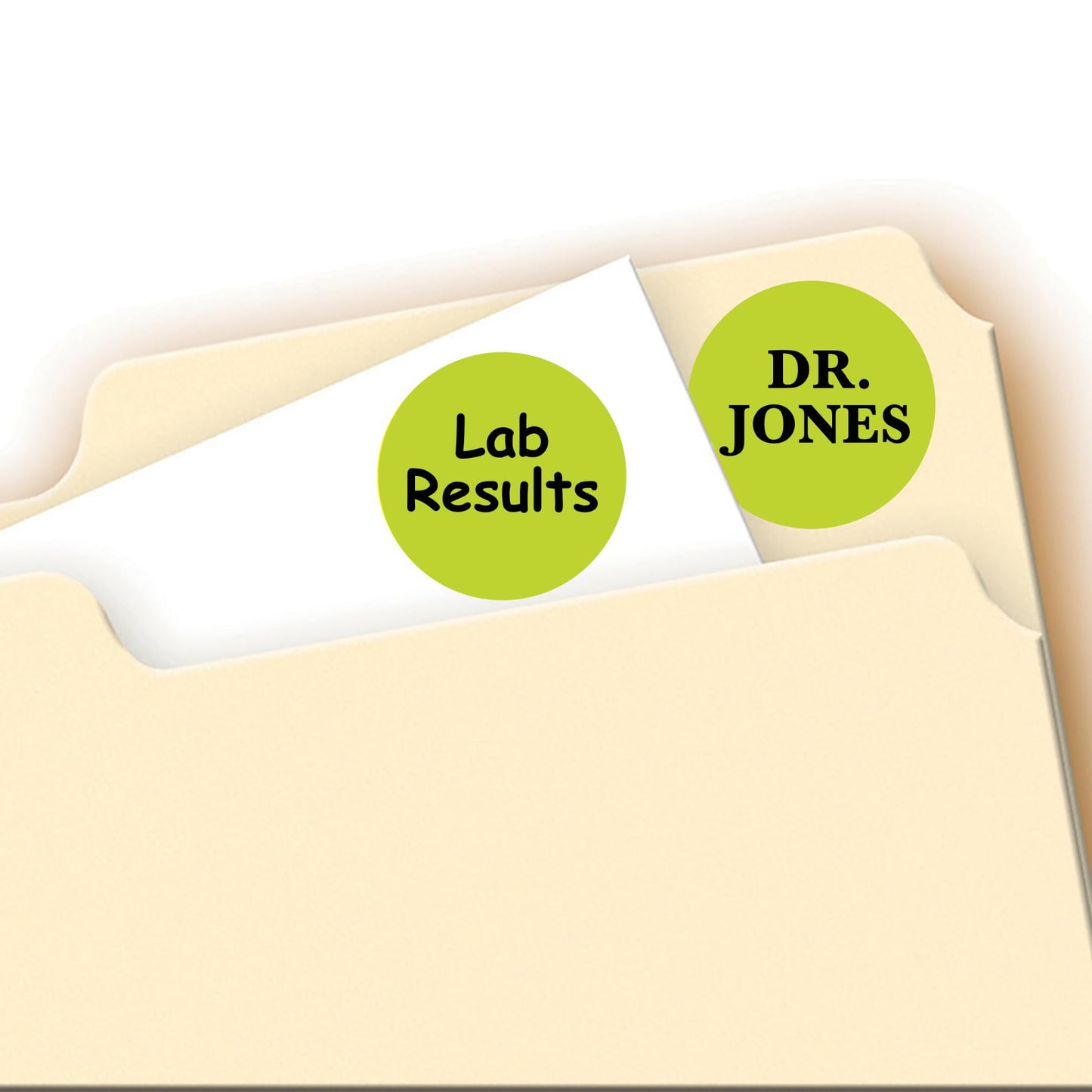 Avery Removable Color-Coding Labels, 3/4" Diameter, Neon Yellow, Laser, 1,008 Total (5470)